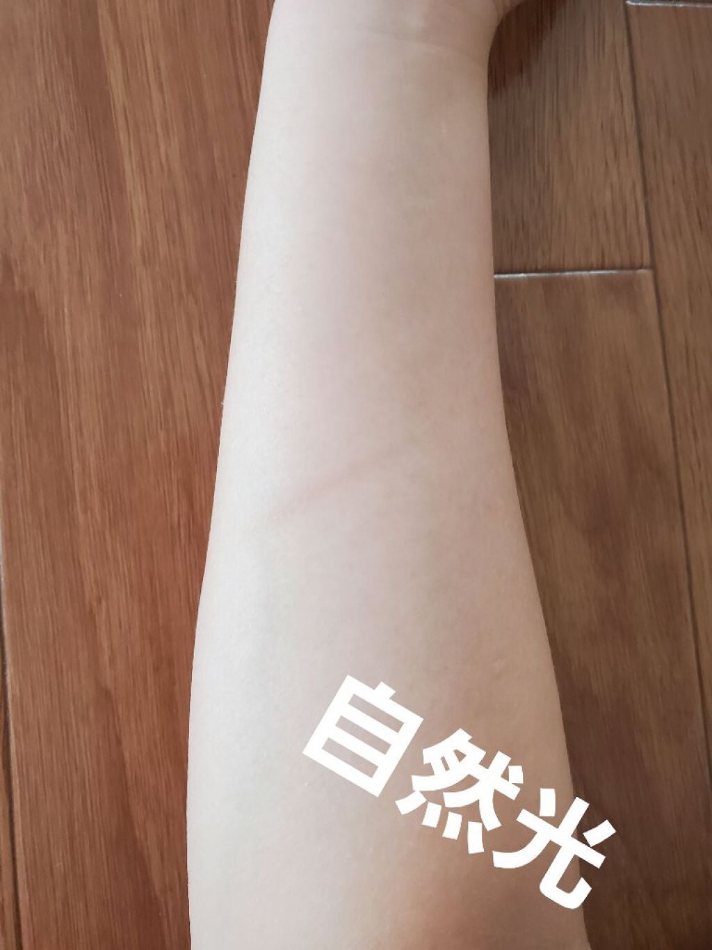 アットノンEX クリーム(医薬品)/アットノン/その他を使ったクチコミ(5枚目)