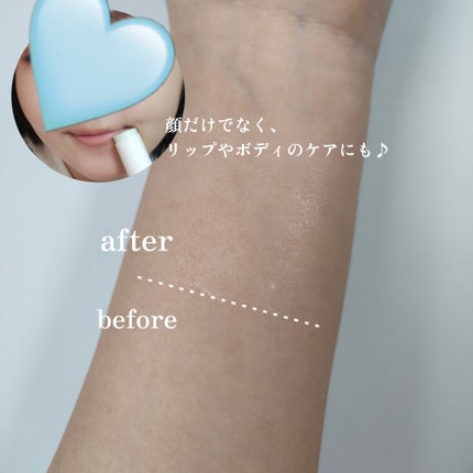 グリーンカーミングセラムミスト/Free Moment /ミスト状化粧水を使ったクチコミ(5枚目)