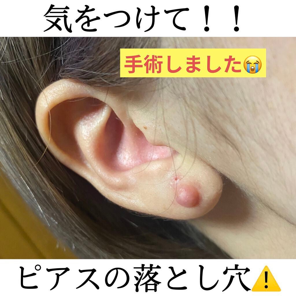 みや on LIPS 「こんばんは〜!!遅くなりましたが、あけましておめでとうございま..」(1枚目)