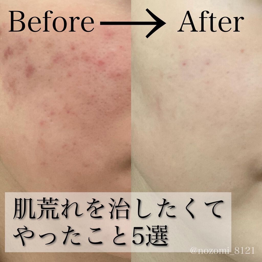 スポンジクリーナーN 199/SHISEIDO/その他化粧小物を使ったクチコミ(1枚目)