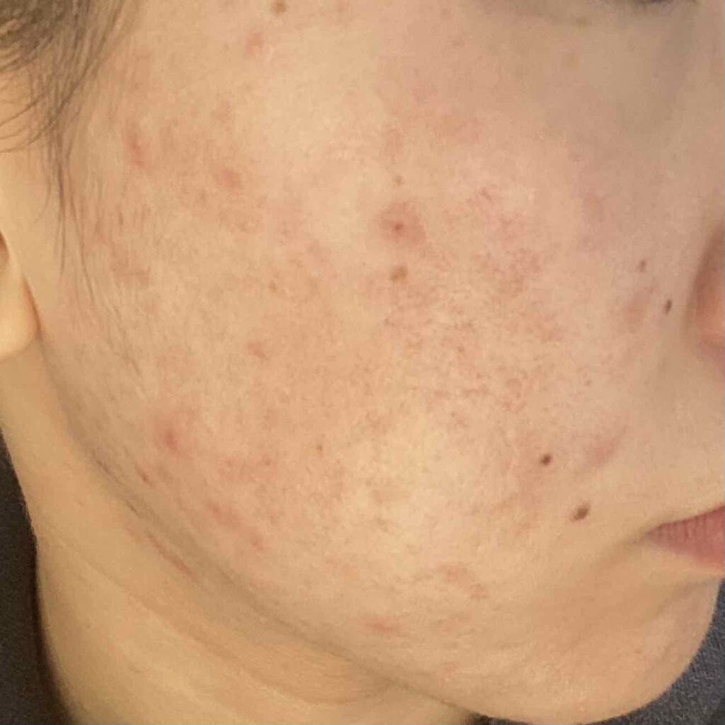 ぺんぎん on LIPS 「⚠️閲覧注意⚠️いつもより光が当たるところで撮っているので見え..」(1枚目)