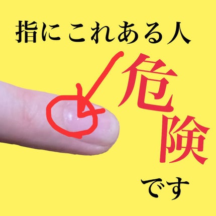 かえる on LIPS 「こんばんはプチプラ大好きかえるです!今回紹介するのは⚠️指に斑..」(1枚目)