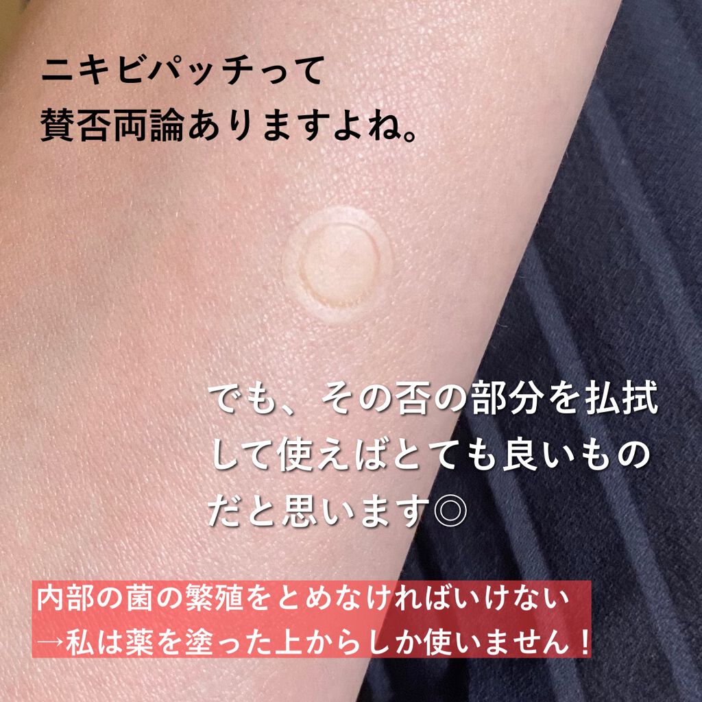 ゼロスポットパッチ/Today’s Cosme/にきびパッチを使ったクチコミ（2枚目）