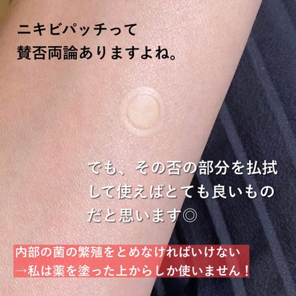 ゼロスポットパッチ/Today’s Cosme/にきびパッチを使ったクチコミ(2枚目)