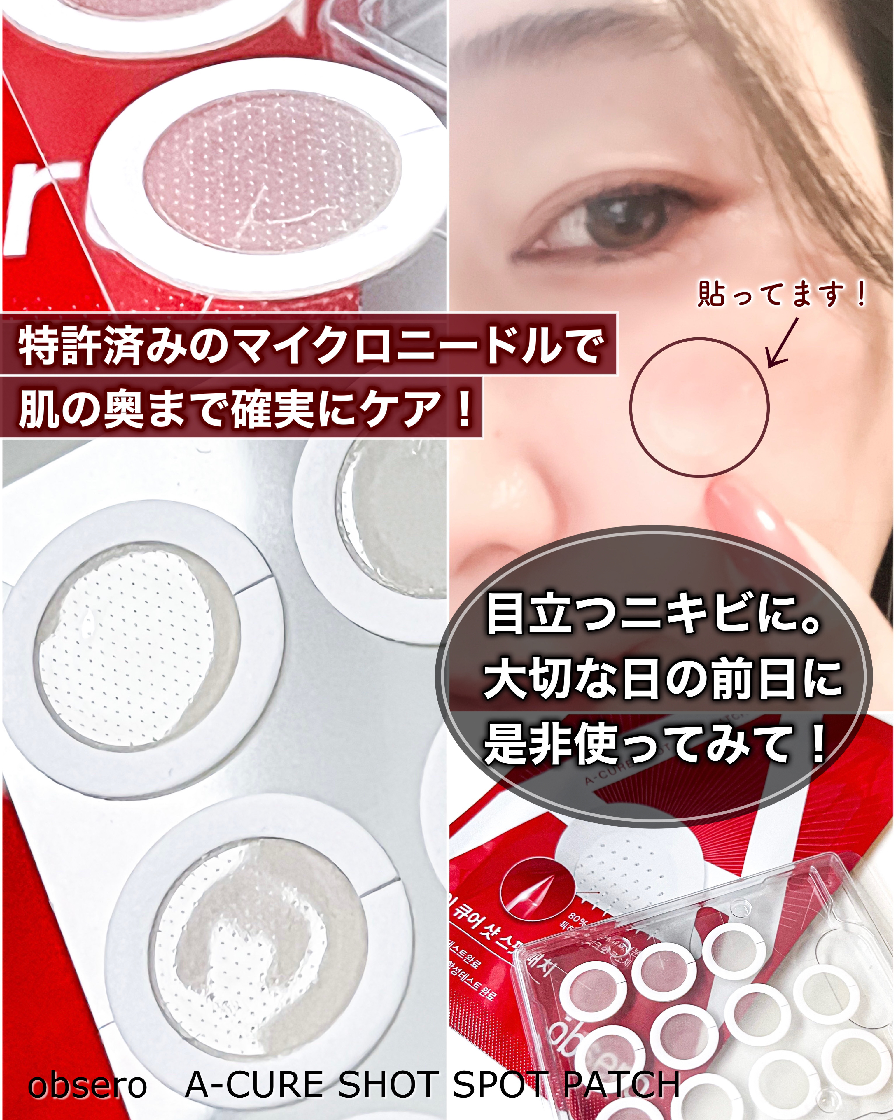 エーキュアショットスポットパッチ/obsero/にきびパッチを使ったクチコミ（1枚目）