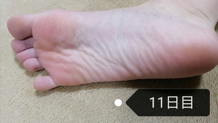 イージーパックDP60分タイプ/ベビーフット/レッグ・フットケアを使ったクチコミ(4枚目)