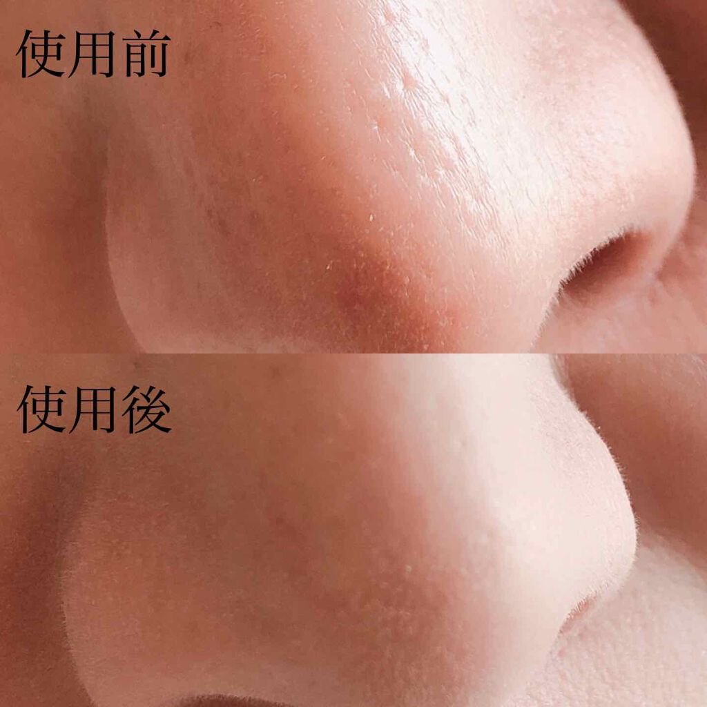 アンフィネス ポア コンシーラー/ALBION/クリームコンシーラーを使ったクチコミ（2枚目）