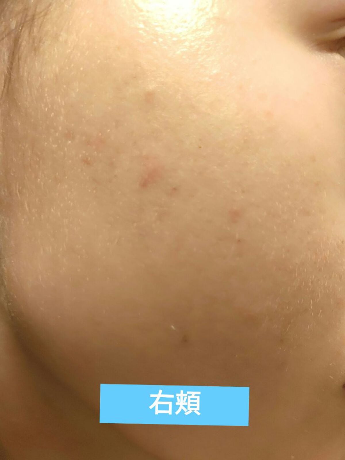 明色美顔水 薬用化粧水/美顔/化粧水を使ったクチコミ(2枚目)