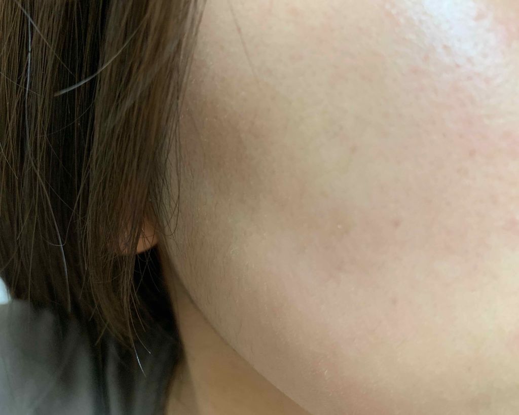 明色美顔水 薬用化粧水/美顔/化粧水を使ったクチコミ(2枚目)