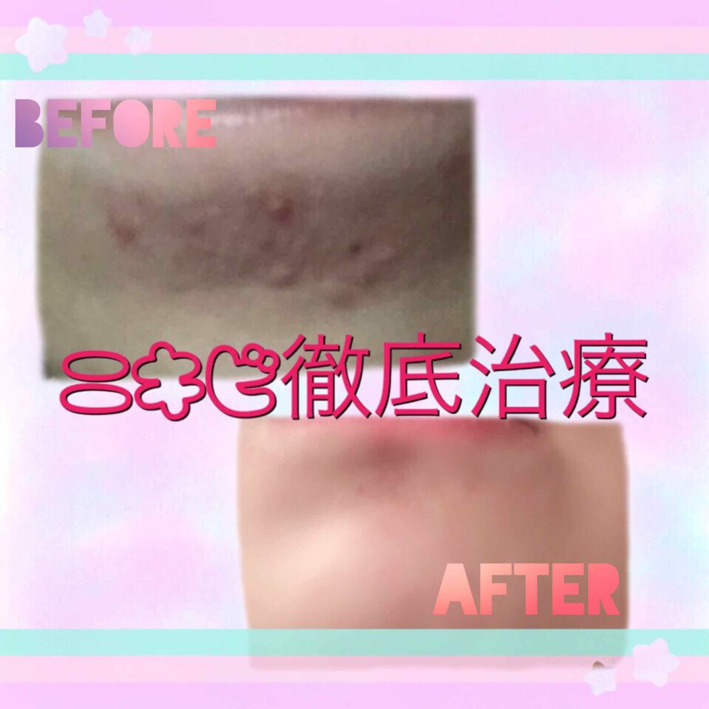 ハトムギ化粧水(ナチュリエ スキンコンディショナー R )/ナチュリエ/化粧水を使ったクチコミ（1枚目）