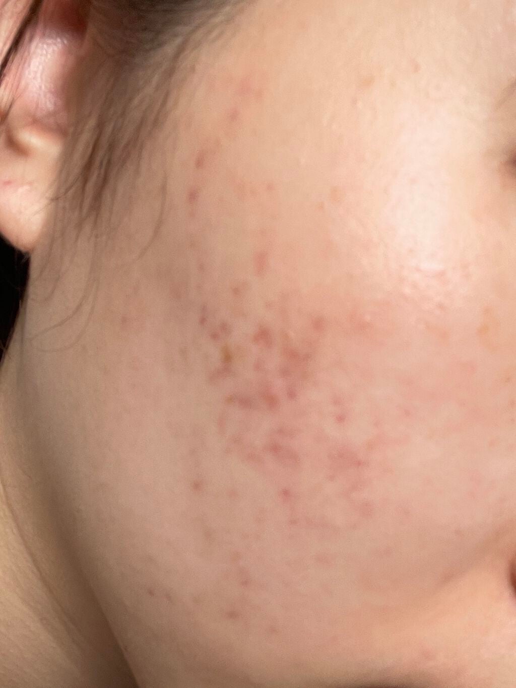 ダブル セラム バーム ファンデーション/Dr.Althea/クリーム・エマルジョンファンデーションを使ったクチコミ(2枚目)