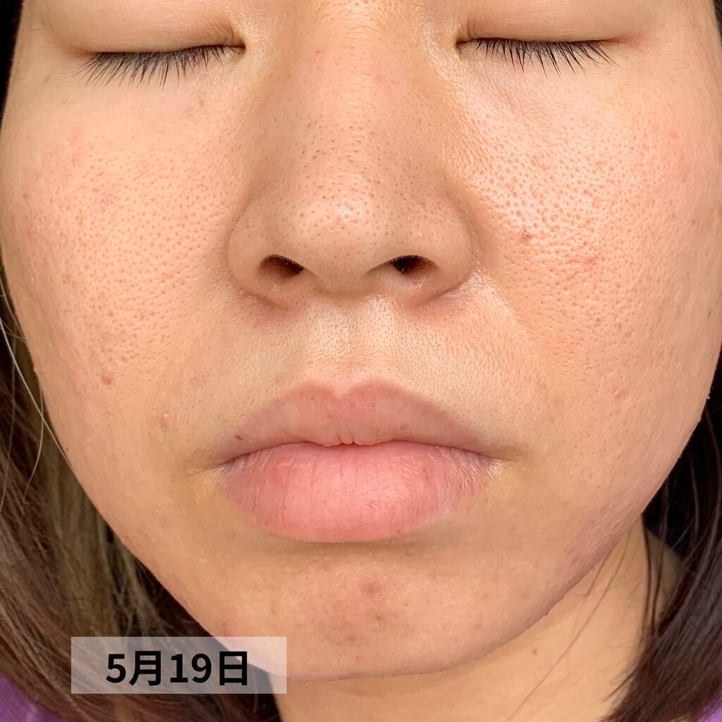 PURE ROSEHIP SEED OIL/Life-flo/フェイスオイルを使ったクチコミ(8枚目)