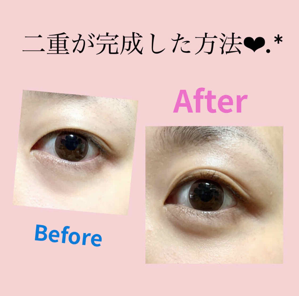 ナイトアイボーテ/StreeTrend/二重まぶた用アイテムを使ったクチコミ（1枚目）