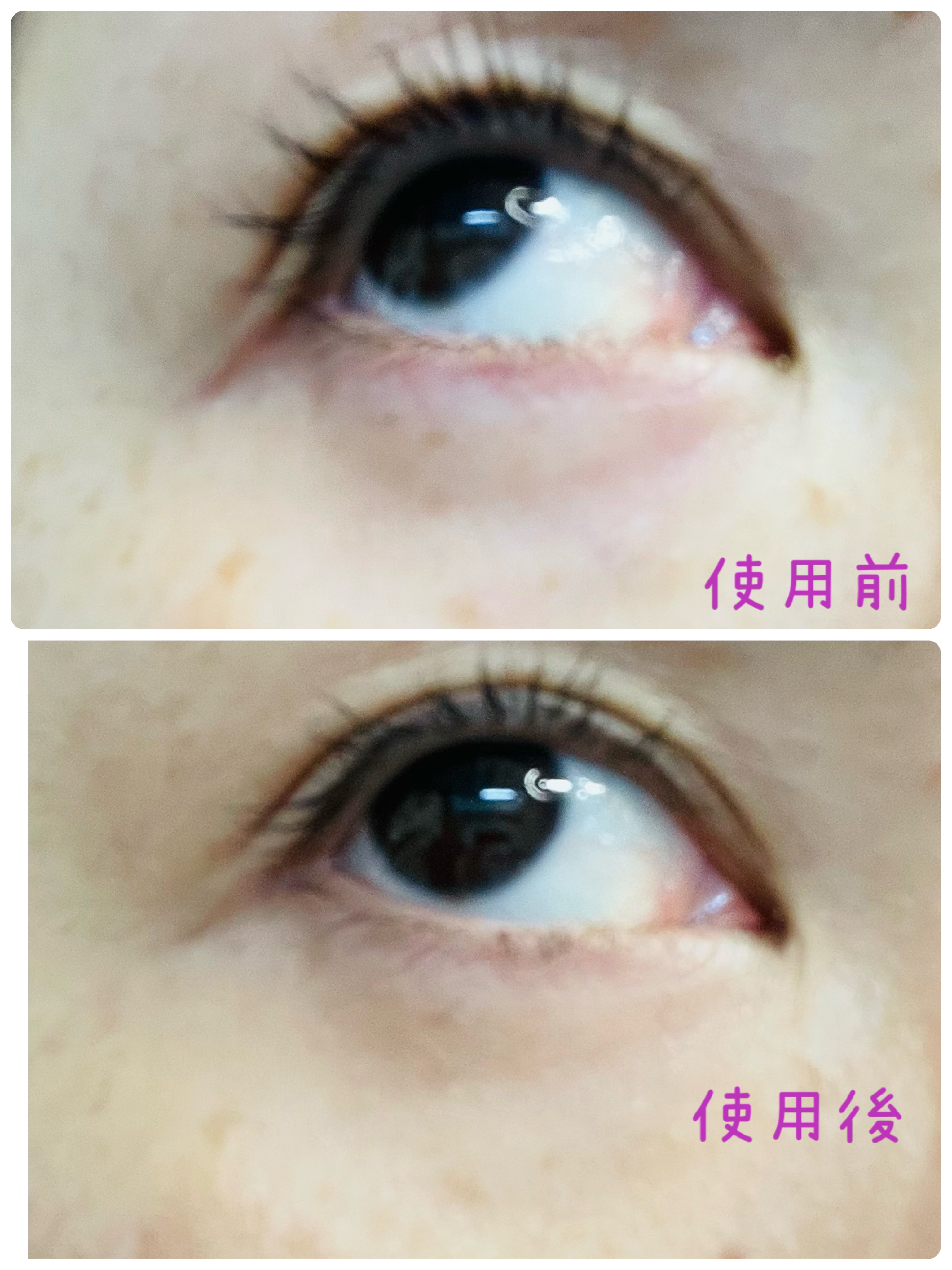 アイレノール クマクリーム/IRENOL/アイケア・アイクリームを使ったクチコミ（3枚目）