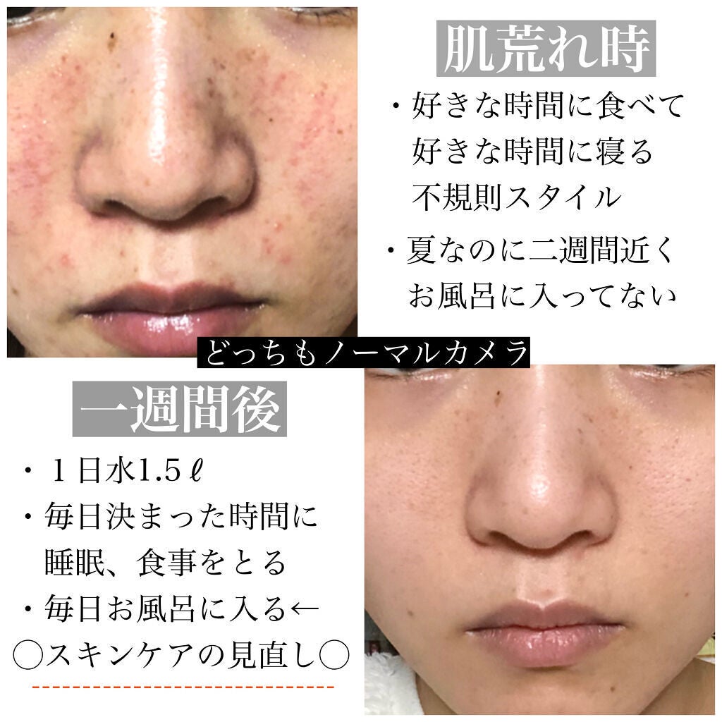 艶肌ドロップ/ラッシュ/美容液を使ったクチコミ(2枚目)