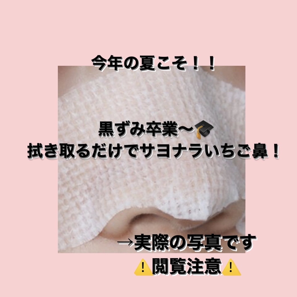 濃密もっちり泡立てネット/ファンケル/その他スキンケアグッズを使ったクチコミ（1枚目）