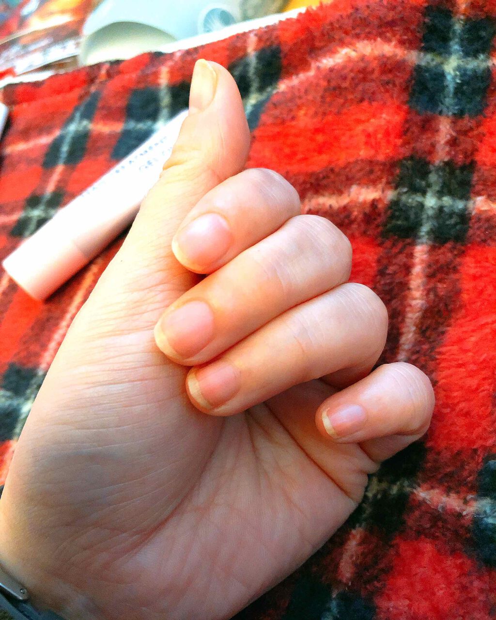 華 on LIPS 「2枚目、使用前3枚目、使用後なんだけど……撮った環境が違いすぎ..」(3枚目)