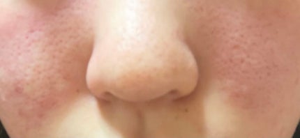 グリーンタンジェリン ビタC ダークスポットケアセラム/goodal/美容液を使ったクチコミ(1枚目)