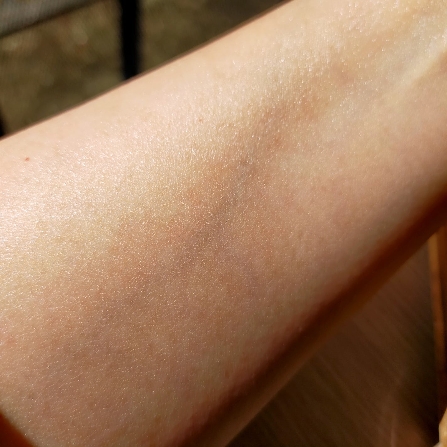 ビタミンミルク/ASUNE /乳液を使ったクチコミ(5枚目)