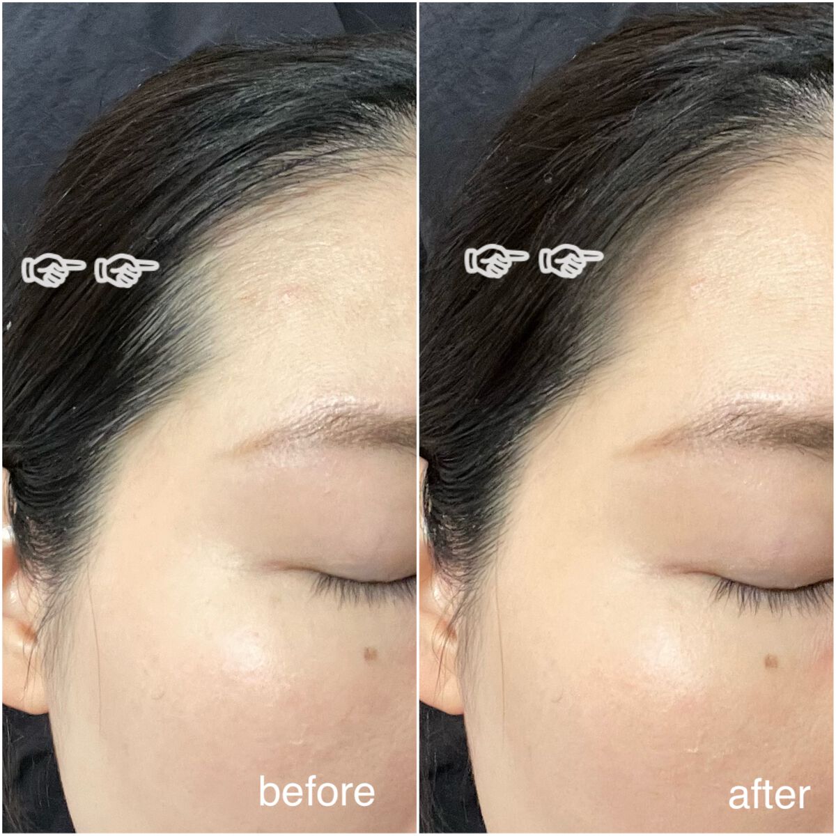 デコシャドウ by.F/Fujiko/シェーディングを使ったクチコミ（1枚目）