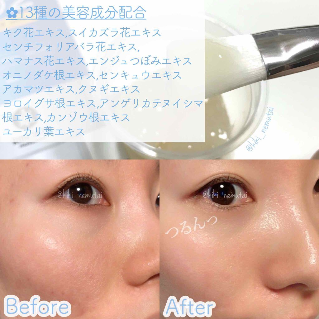 CARBOXYカーボキシー炭酸パック/CARBOXY/シートマスク・パックを使ったクチコミ(4枚目)