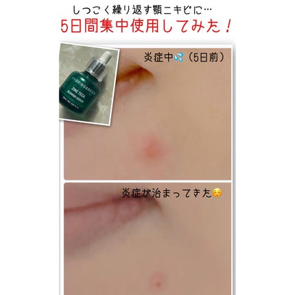 ジンクテカBセラム/BRING GREEN/美容液を使ったクチコミ(5枚目)