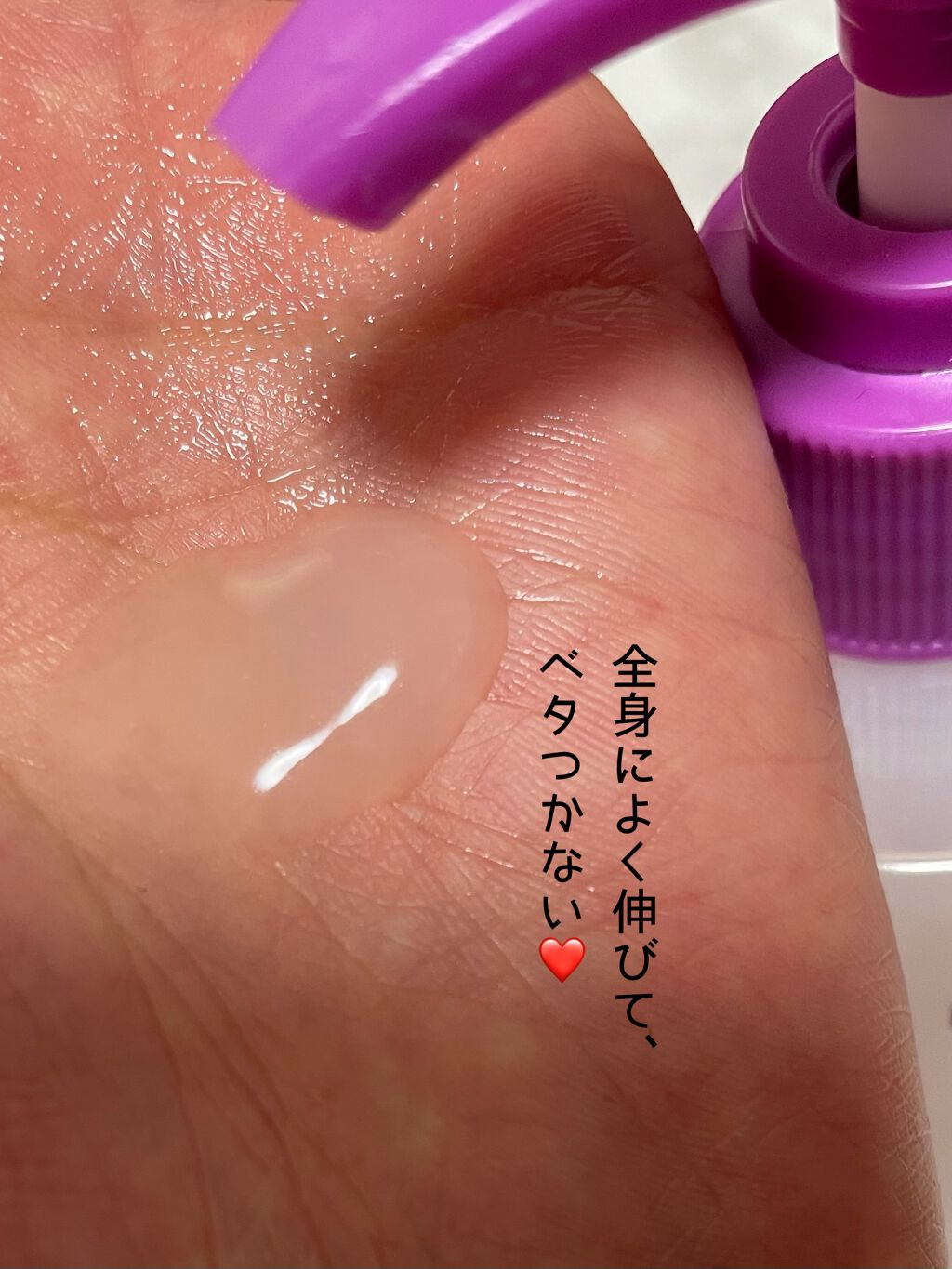 薬用 かさ肌かゆ肌ミルキージェル/ベルサンテ/ボディローションを使ったクチコミ(2枚目)