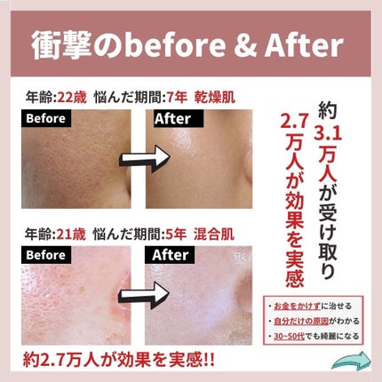 あなたの肌に合ったスキンケア💐コーくん先生 on LIPS 「【もしかしてやってないよね??】コレしてると毛穴一生消えません..」(7枚目)