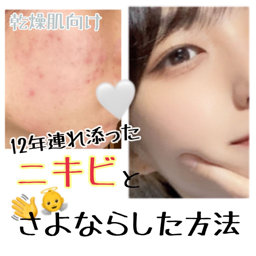 デュオ ザ クレンジングバーム/DUO/クレンジングバームを使ったクチコミ(1枚目)