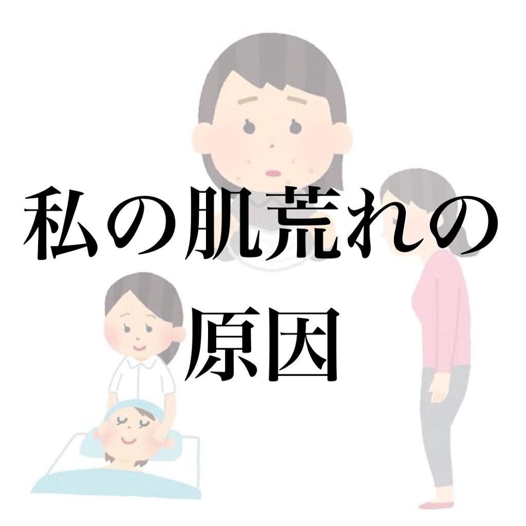 さい on LIPS 「💡ニキビに悩む人に見てほしい💡///※あくまで私のリマインド用..」(1枚目)