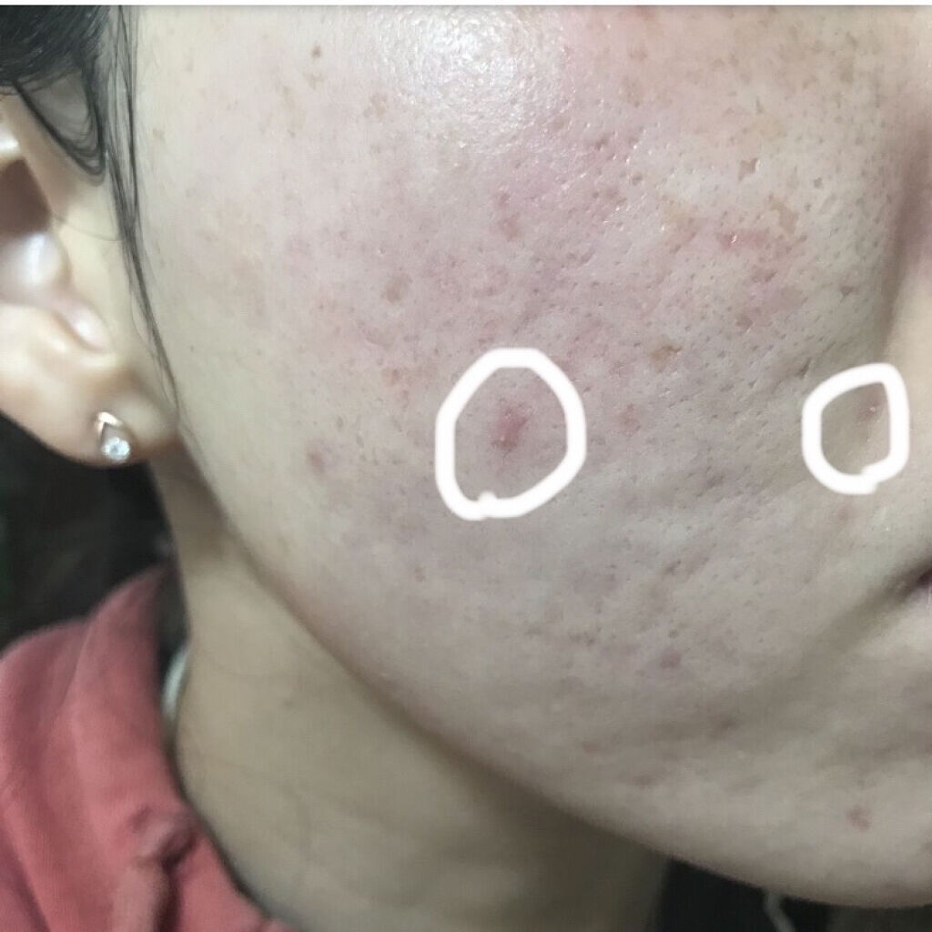 キャスターオイル/Now Foods/その他スキンケアを使ったクチコミ（3枚目）