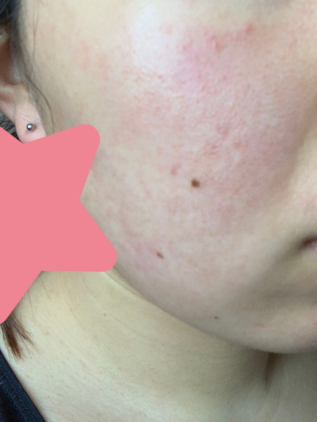 ハトムギ化粧水(ナチュリエ スキンコンディショナー R )/ナチュリエ/化粧水を使ったクチコミ(3枚目)