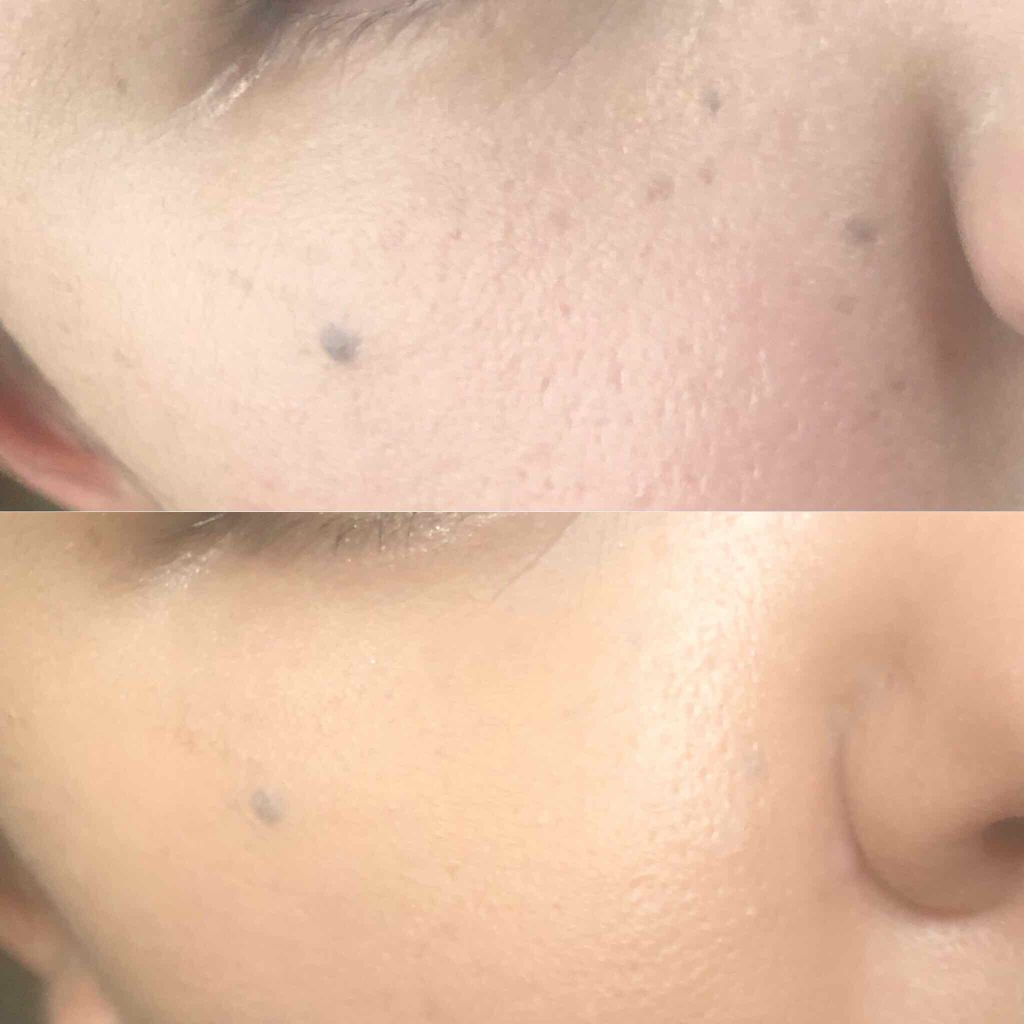 ミネラルシルクファンデーション(ケース・パフ付)/ヴァントルテ/パウダーファンデーションを使ったクチコミ(1枚目)