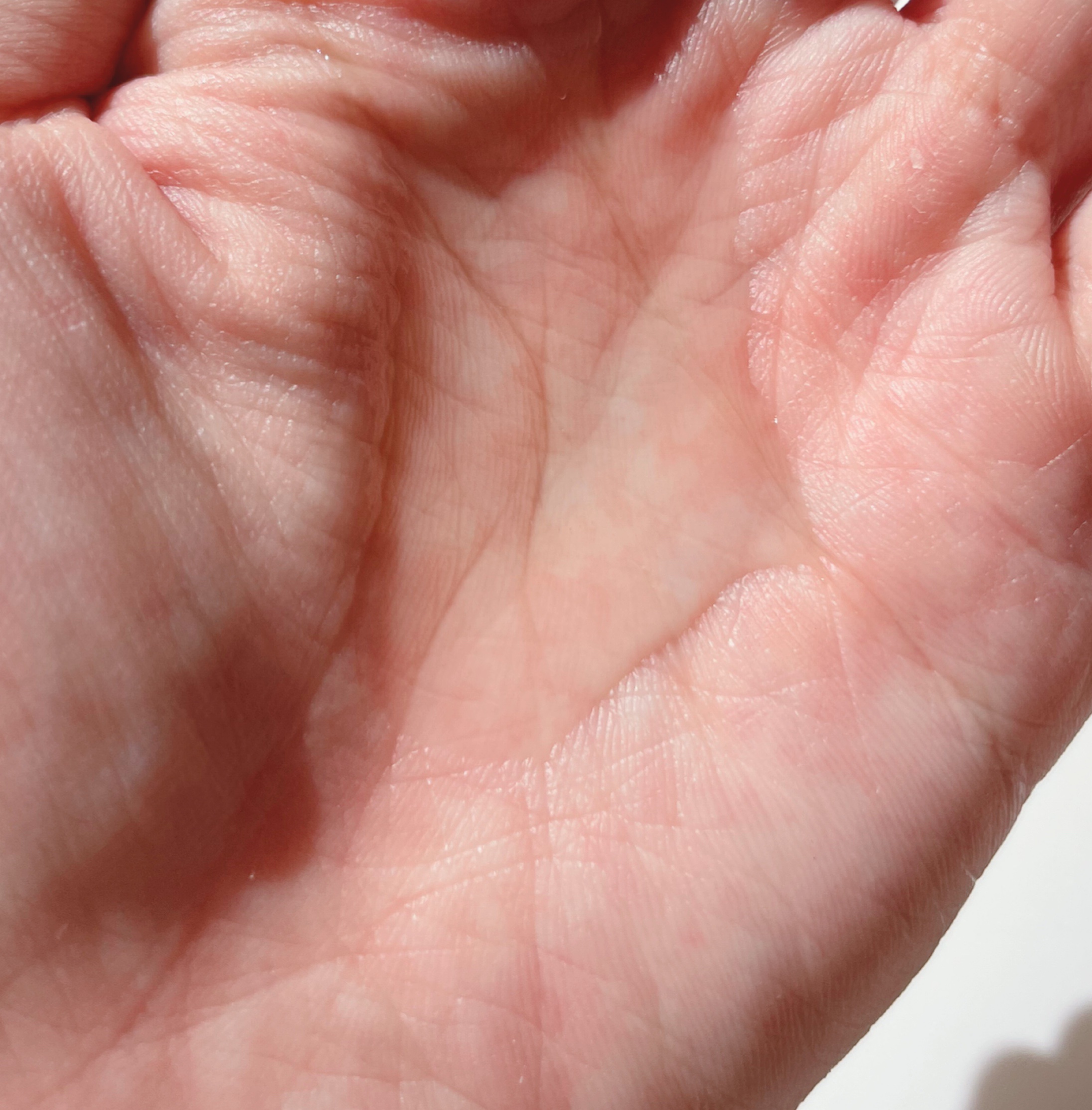 SUNGBOON EDITOR（成分エディター） グリーントマト ポアリフティング アンプルトナーのクチコミ「「毛穴の帝王グリーントマト🍅🟢」


• ───── ✾ ───── •


SUNGBOON.....」（2枚目）