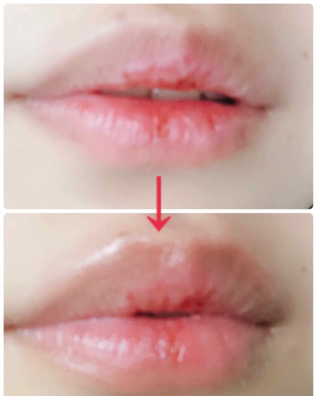 BubiBubi Lip/unpa/リップケアを使ったクチコミ（2枚目）