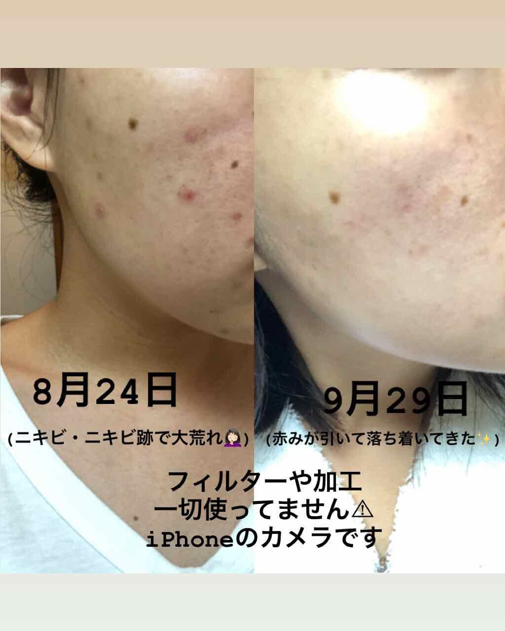 B-SALIC2.0 ASTAZET4.0/CHICAY CHICO/フェイスクリームを使ったクチコミ(2枚目)