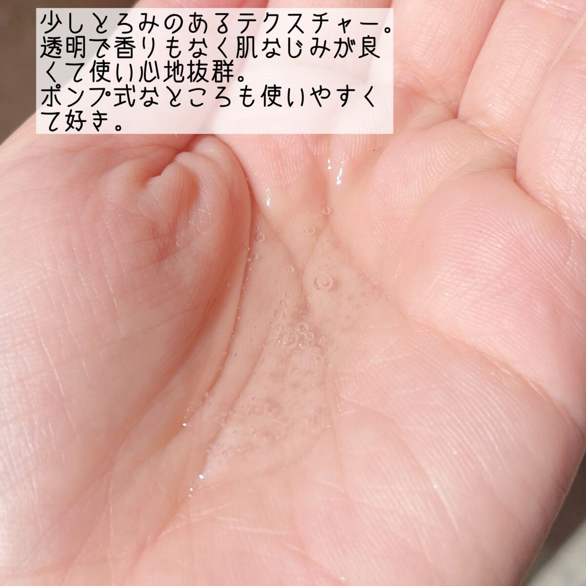 バイタルアクト ローション MB/d プログラム/化粧水を使ったクチコミ（3枚目）