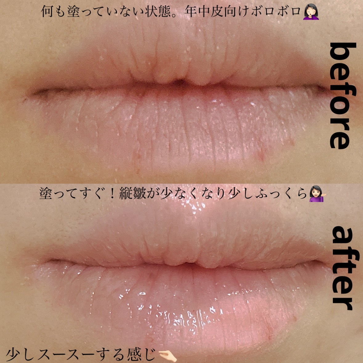 レチノール ボリューム リップセラム/primera/リップグロスを使ったクチコミ(3枚目)