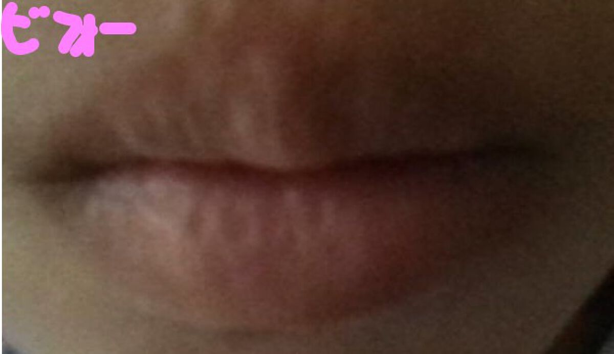 サンリオリップクリーム/サンリオ/リップクリームを使ったクチコミ（1枚目）