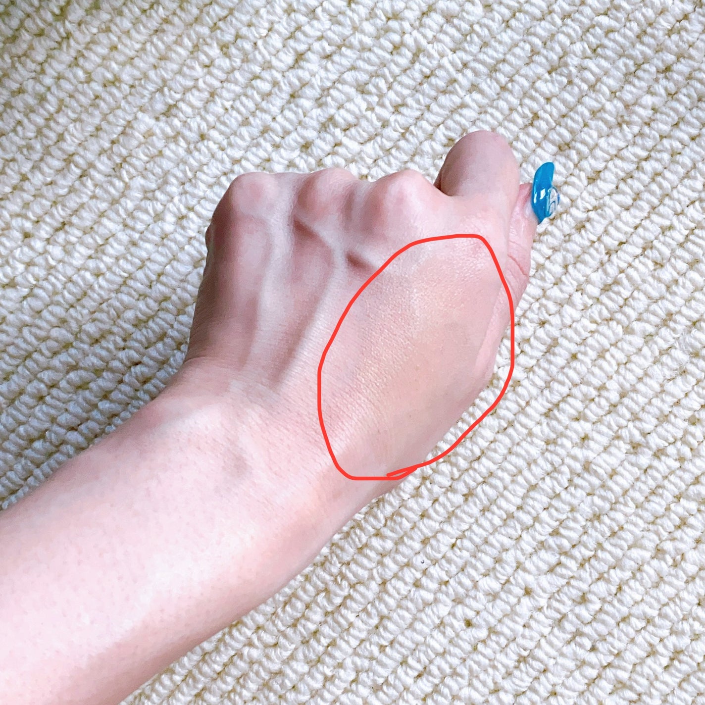 ミネラルインナートリートメントリキッドコンシーラー/エトヴォス/リキッドコンシーラーを使ったクチコミ(5枚目)