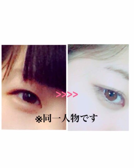 アイトーク/アイトーク/二重まぶた用アイテムを使ったクチコミ(2枚目)