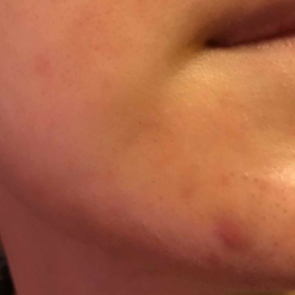 薬用 しみ 集中対策 美容液/メラノCC/美容液を使ったクチコミ（3枚目）