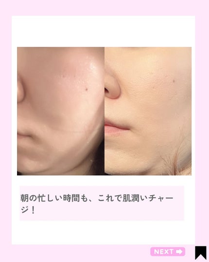 ダイブイン セラム/Torriden/美容液を使ったクチコミ(7枚目)