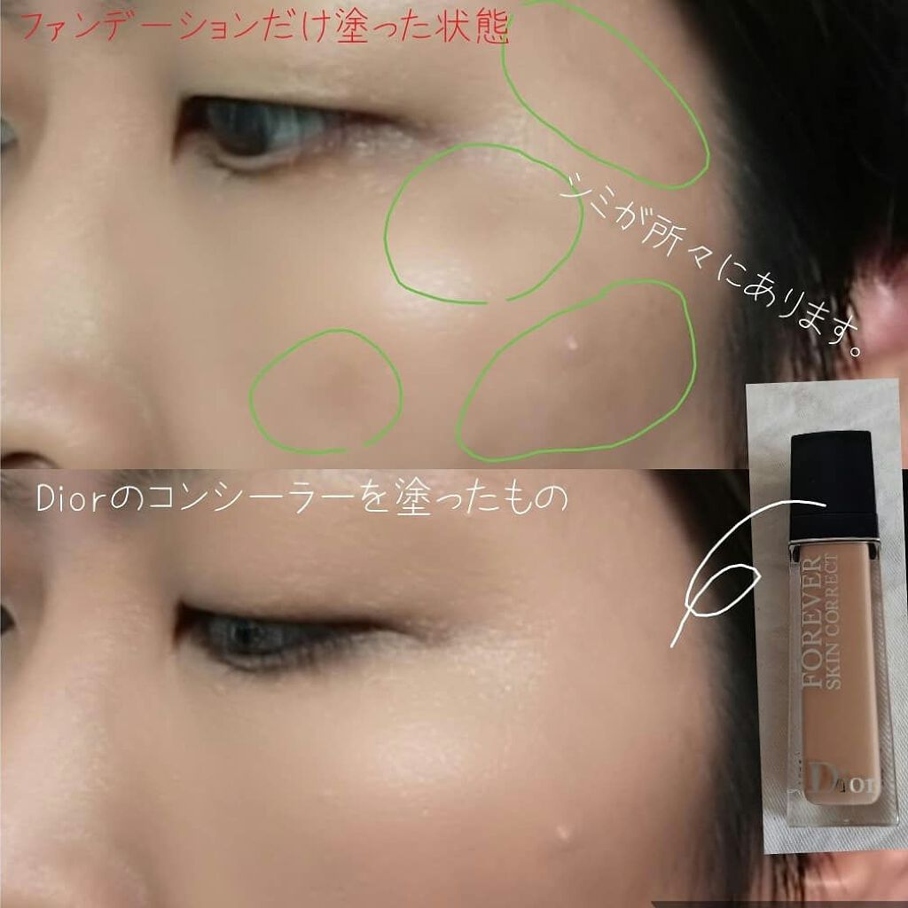 【旧】ディオールスキン フォーエヴァー スキン コレクト コンシーラー/Dior/リキッドコンシーラーを使ったクチコミ(2枚目)
