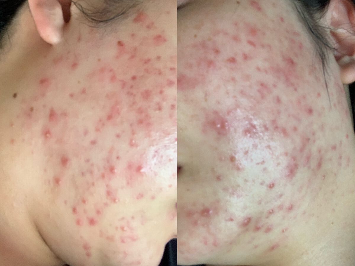 CICA スキン/VT/化粧水を使ったクチコミ(1枚目)