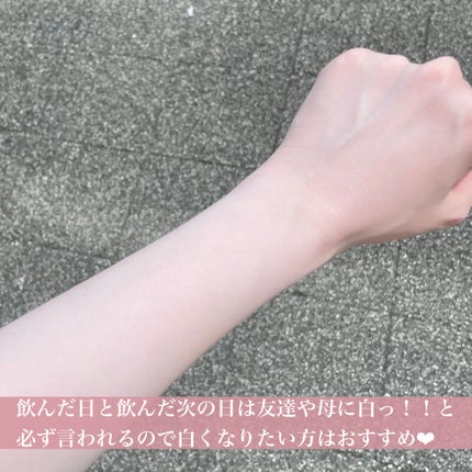 アイロホワイタチオン/東亜製薬/美容サプリメントを使ったクチコミ(4枚目)