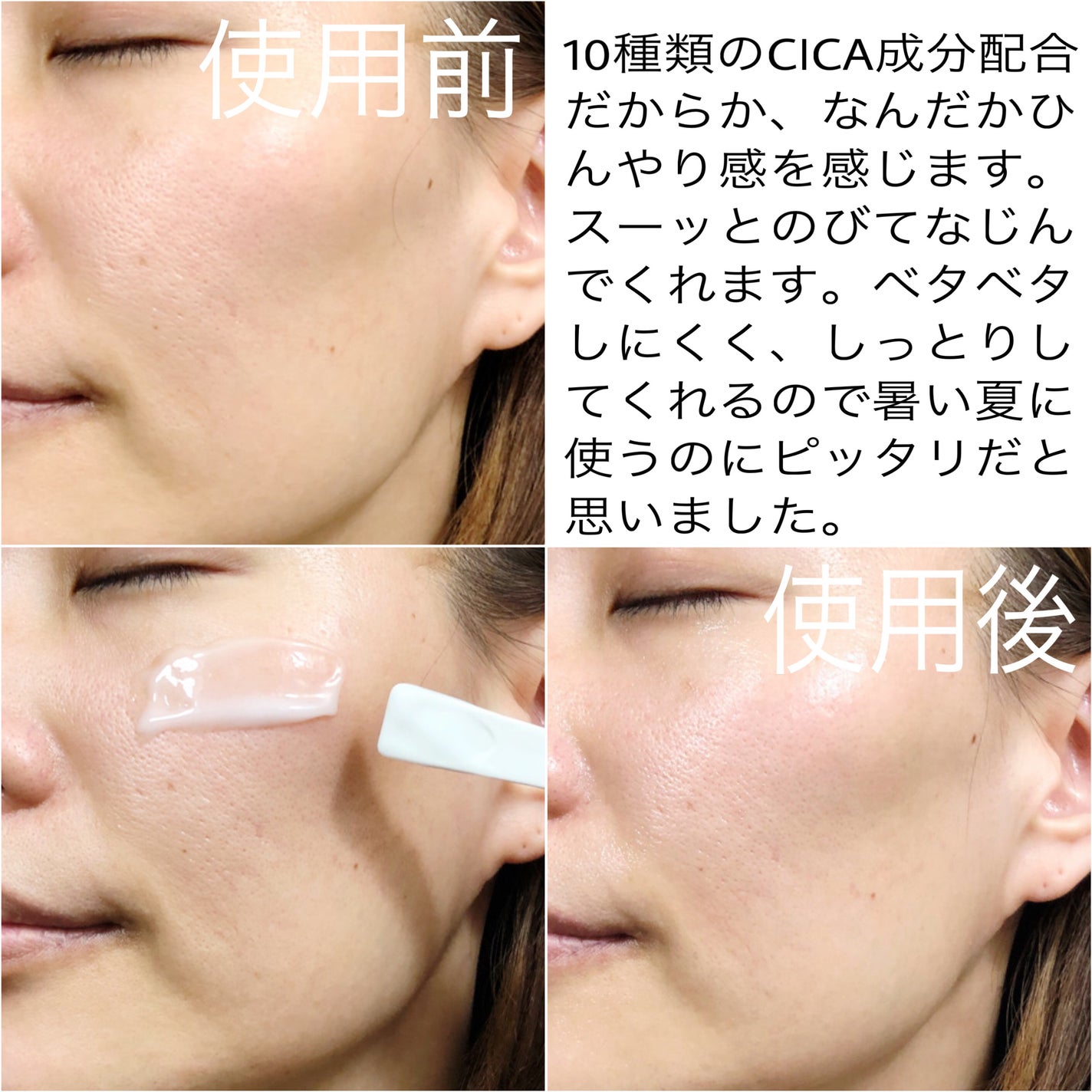 レッドブレミッシュ クリアスージングクリーム/Dr.G/フェイスクリームを使ったクチコミ(6枚目)