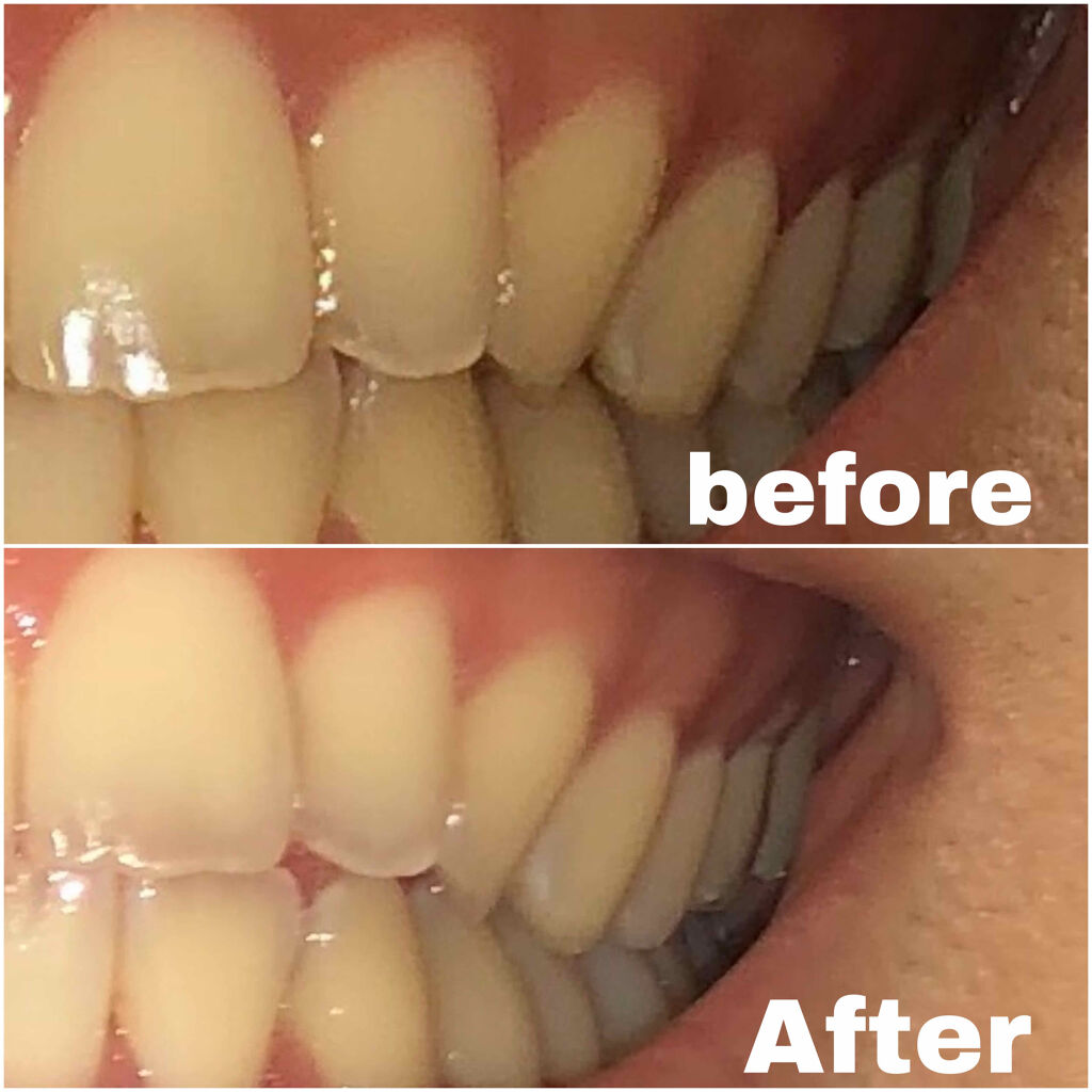 プレミアム クレンジングペースト/オーラツー/歯磨き粉を使ったクチコミ（3枚目）