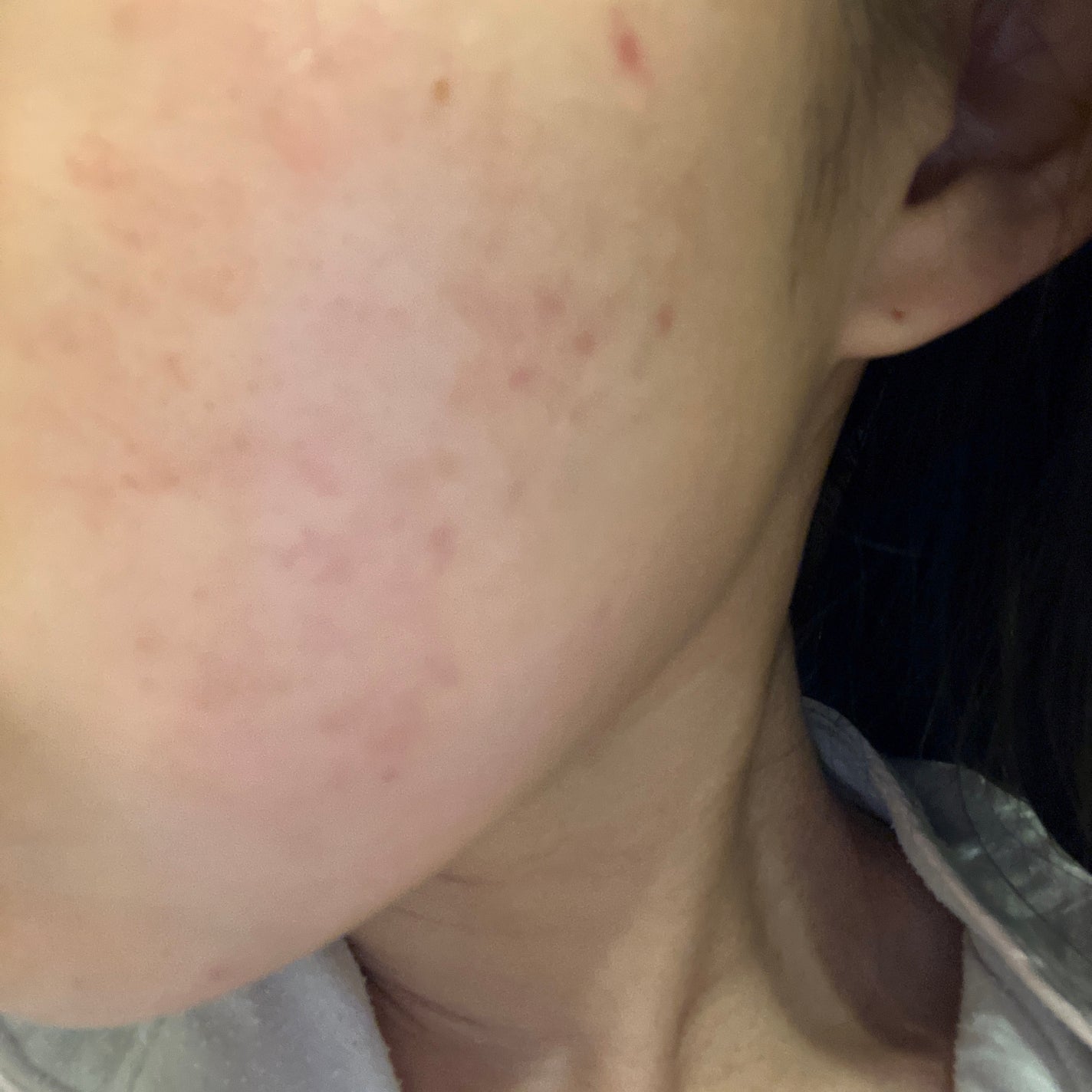 薬用 しみ 集中対策 美容液/メラノCC/美容液を使ったクチコミ(1枚目)