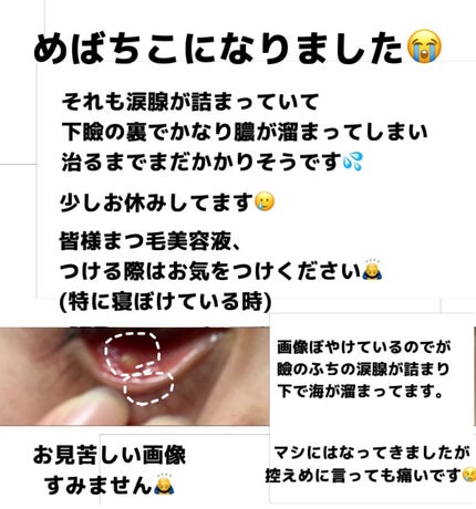 EMAKED(エマーキット)/水橋保寿堂製薬/まつげ美容液を使ったクチコミ(2枚目)